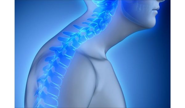 How to Get Rid of a Neck Hump